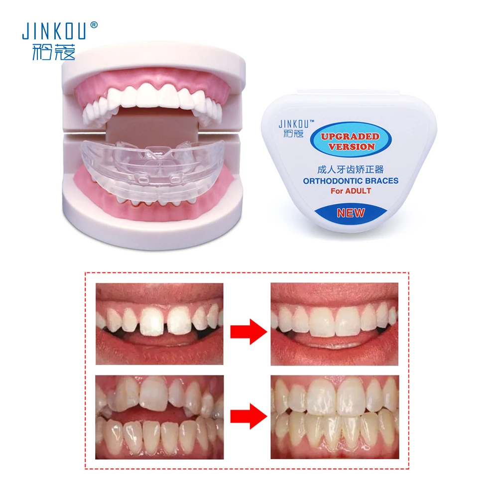 

Adult Orthodontics Braces Dental Orthodontic Retainers T4A Tooth Dental Orthotics Teeth Whitening Tooth Alignment Tool