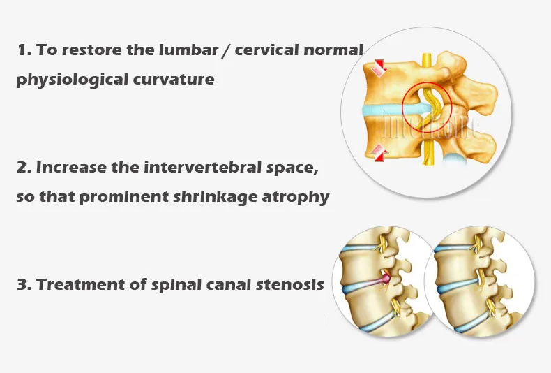 Lumbar-traction-device-B30-2-(10)