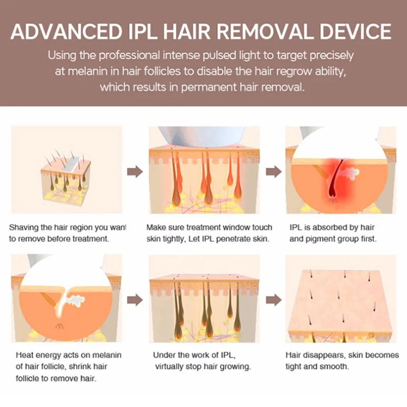 IPL лазерный электрический эпилятор для удаления льда, перманентное удаление волос, триммер для домашнего бикини, Электрический Фотоэпилятор