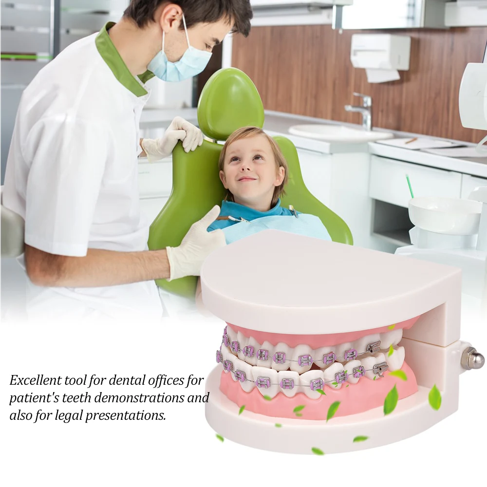 

Dental Orthodontic Mallocclusion Model with Brackets Archwire Buccal Tube Teeth Model for Patient Communication Adult Teaching