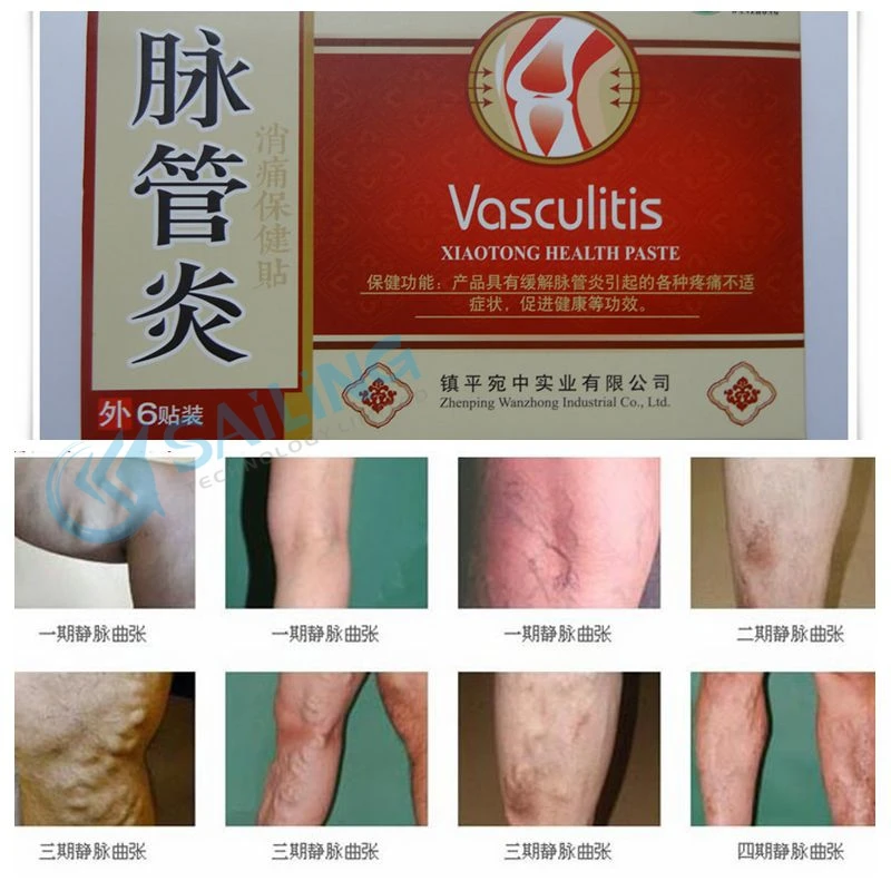 Buy 42pcs mai guan yan varicose veins treatment
