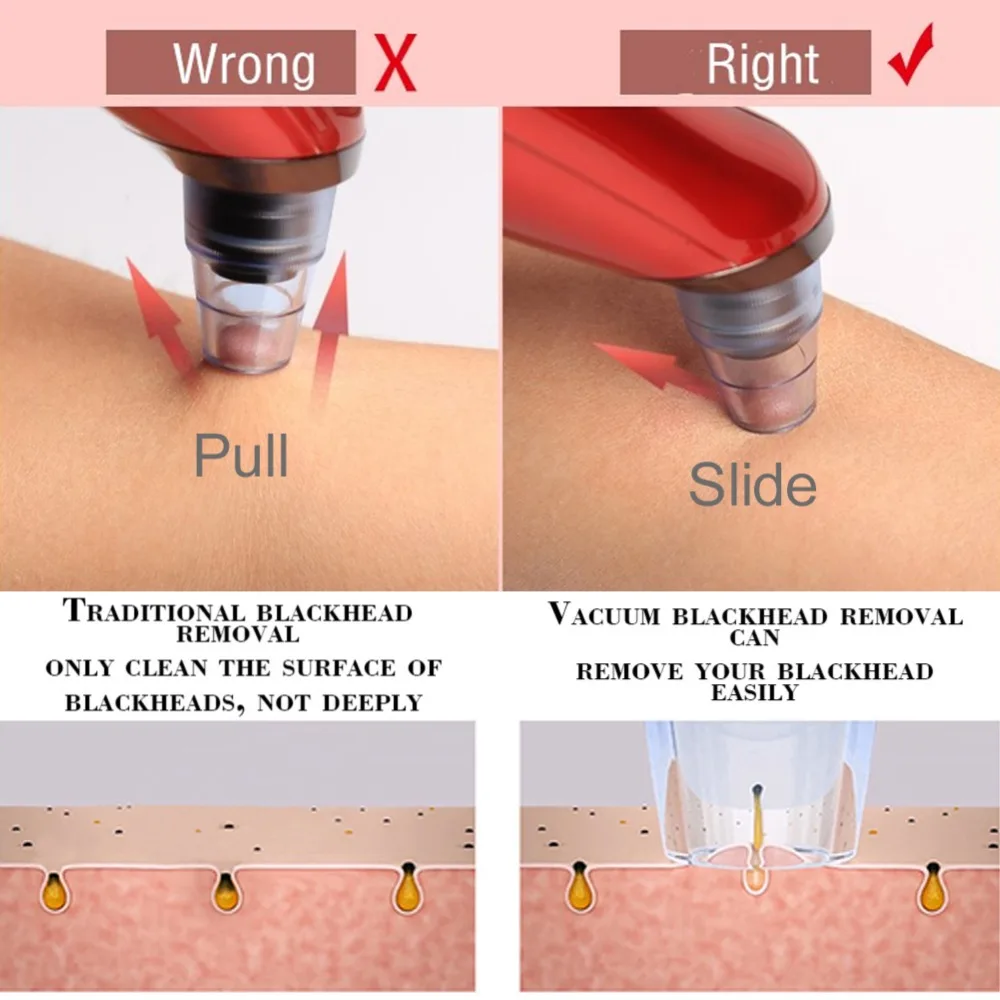 Вакуумные Электрический Очиститель пор акне угрей удаления извлечения USB перезаряжаемые Comedo угольная маска для носа красота Tool Kit