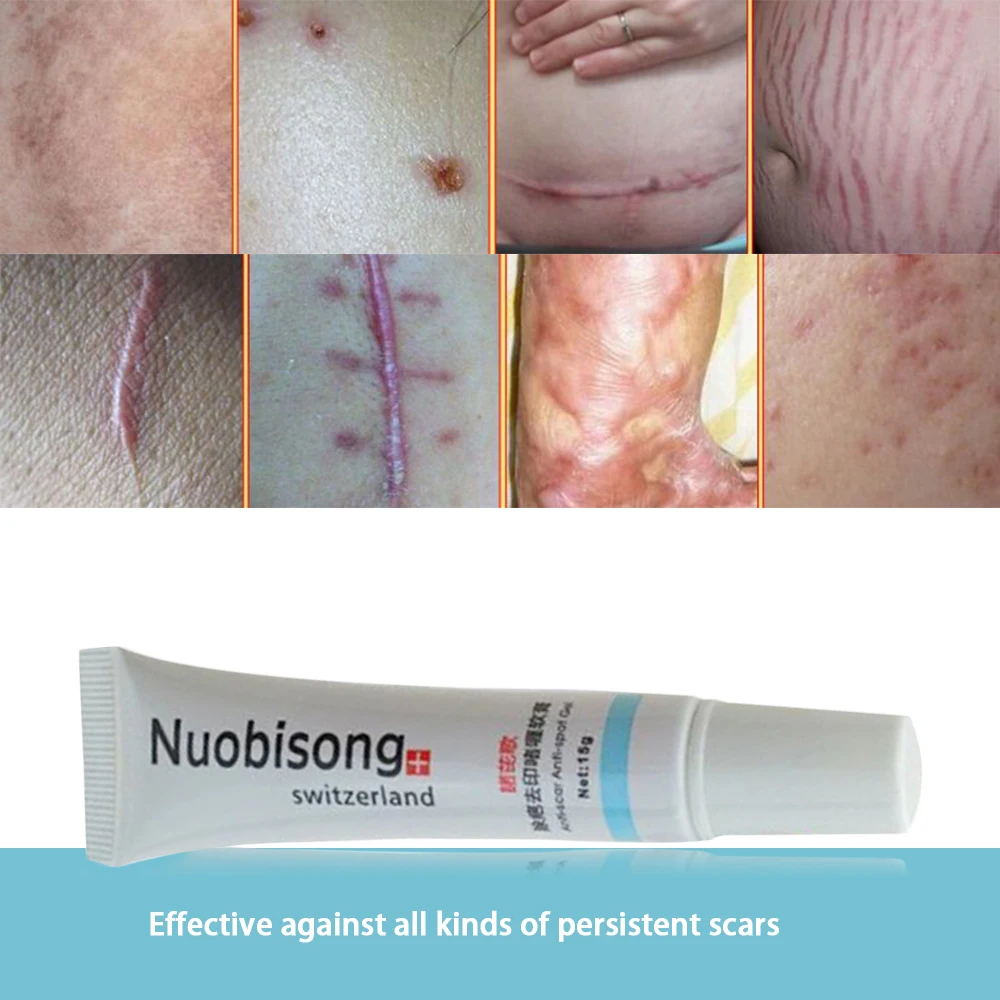 

Super Nuobisong Remove Scar Cream Remove Acne Spots Remove Striae Gravidarum Pigmentation Corrector Anti-Aging Moisturizing 15ml