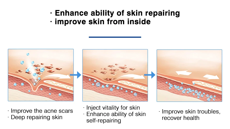Rejuvenescimento da Pele Fator de Reparo Cuidados com a Pele Creme para o Rosto Senhora Soro Acne Tratamento Liofilizado pó Rosto Ageless Omy 12 Omy senhora rejuvenescimento da pele soro acne
