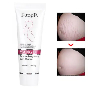 

Natural Mild Stretch Marks Cream Postpartum Repairing Scar Wrinkles Diluting Removal Stretch Marks Cream