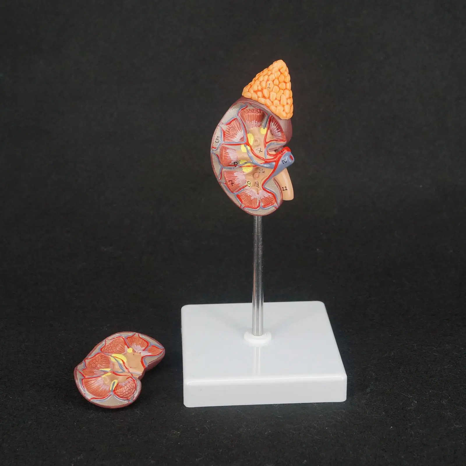 PVC Human Kidney with Adrenal Gland Anatomical Medical Model Urology Anatomy Natural Life Size