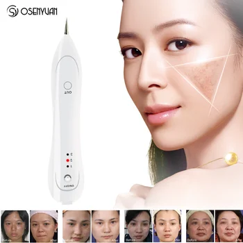 

Best Laser Freckle Removal Machine Skin Mole Removal Dark Spot Remover for Face Wart Tag Tattoo Remaval Pen Salon Beauty