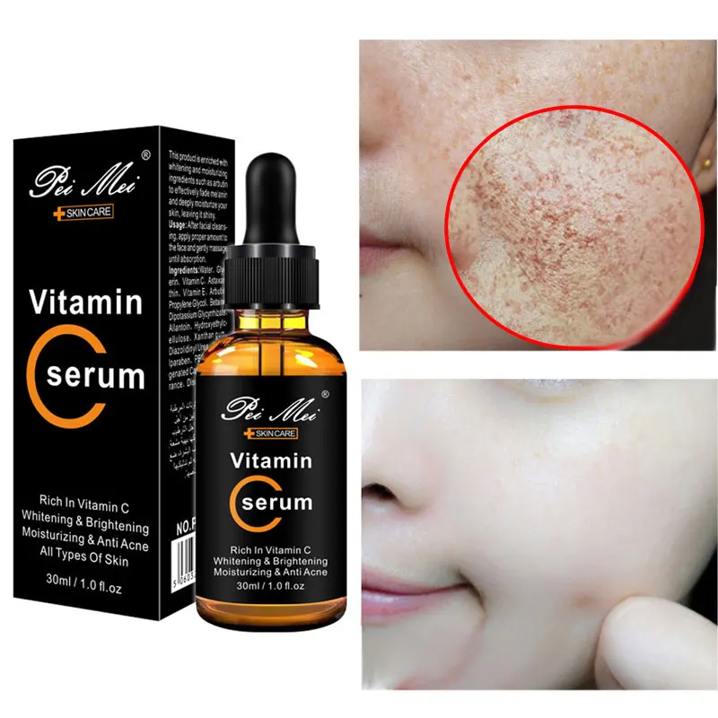 

Pei Mei Vitamin C20 Face Serum Whitening Brightening Moisturizing Anti Acne Anti Aging Reduces Age Spots anti Freckles Fade Dark