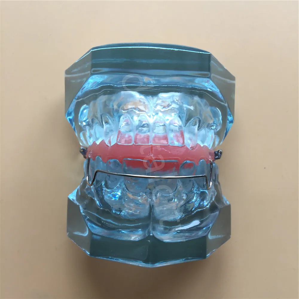 Стоматологический функциональный ортопедический бионатор съемная модель 3006 Стоматологическая обучающая модель зубов