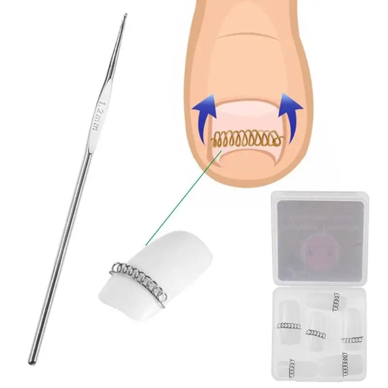 Ingrown Toenail Correction Wire Sticker Fixer pedicure Recover