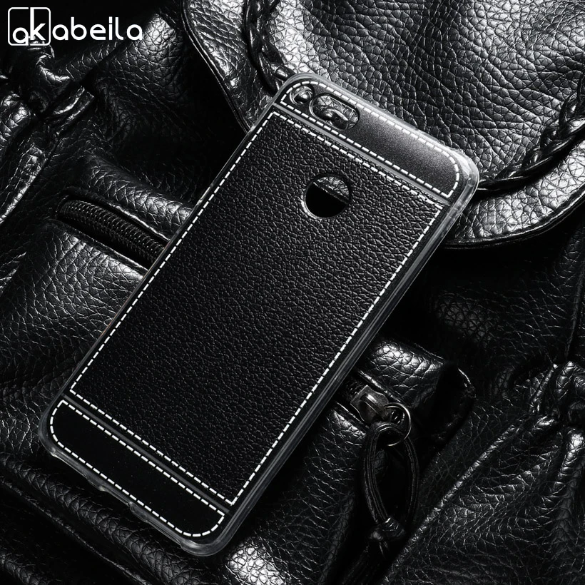 

AKABEILA Phone Cover Cases For ZTE Nubia Z11 mini S NX549J 4G LTE 5.2 inch Covers Soft TPU Litchi Phone Back Bags Silicone Skin