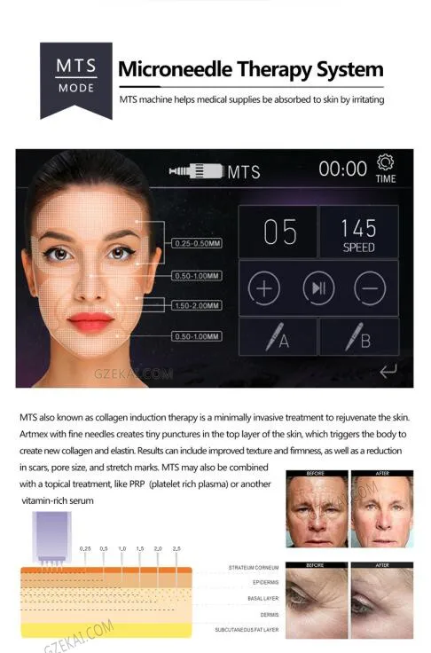 HTB135YgOVXXXXbgXpXXq6xXFXXXE