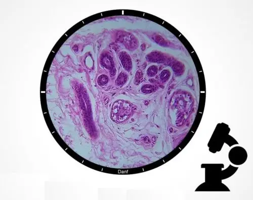 

5PCS Biological Microscope Human Sweat Gland Specimen Selected Prepared Slides