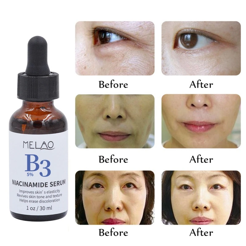 vitamin b3 moisturizer