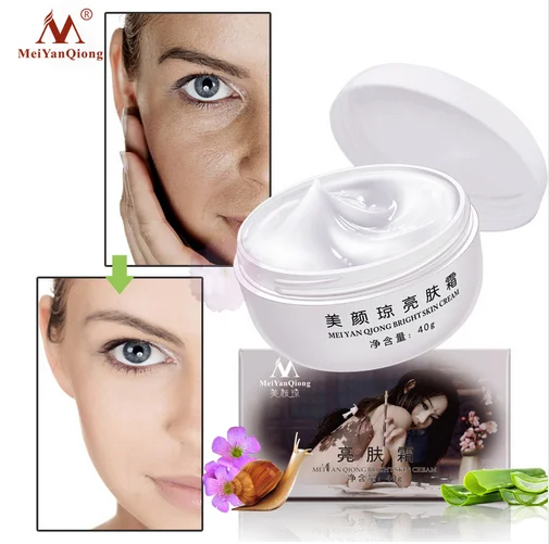 

40g Whitening Freckle Cream Strong Effects Powerful Remove Melasma Acne Spots Pigment Melanin Dark Spots Face Care Cream TSLM1