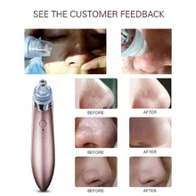 New Arrival Comedo Blackhead Vacuum Suction Diamond Removal Wrink Acne Pore Peeling Face Clean Facial Skin Care W1