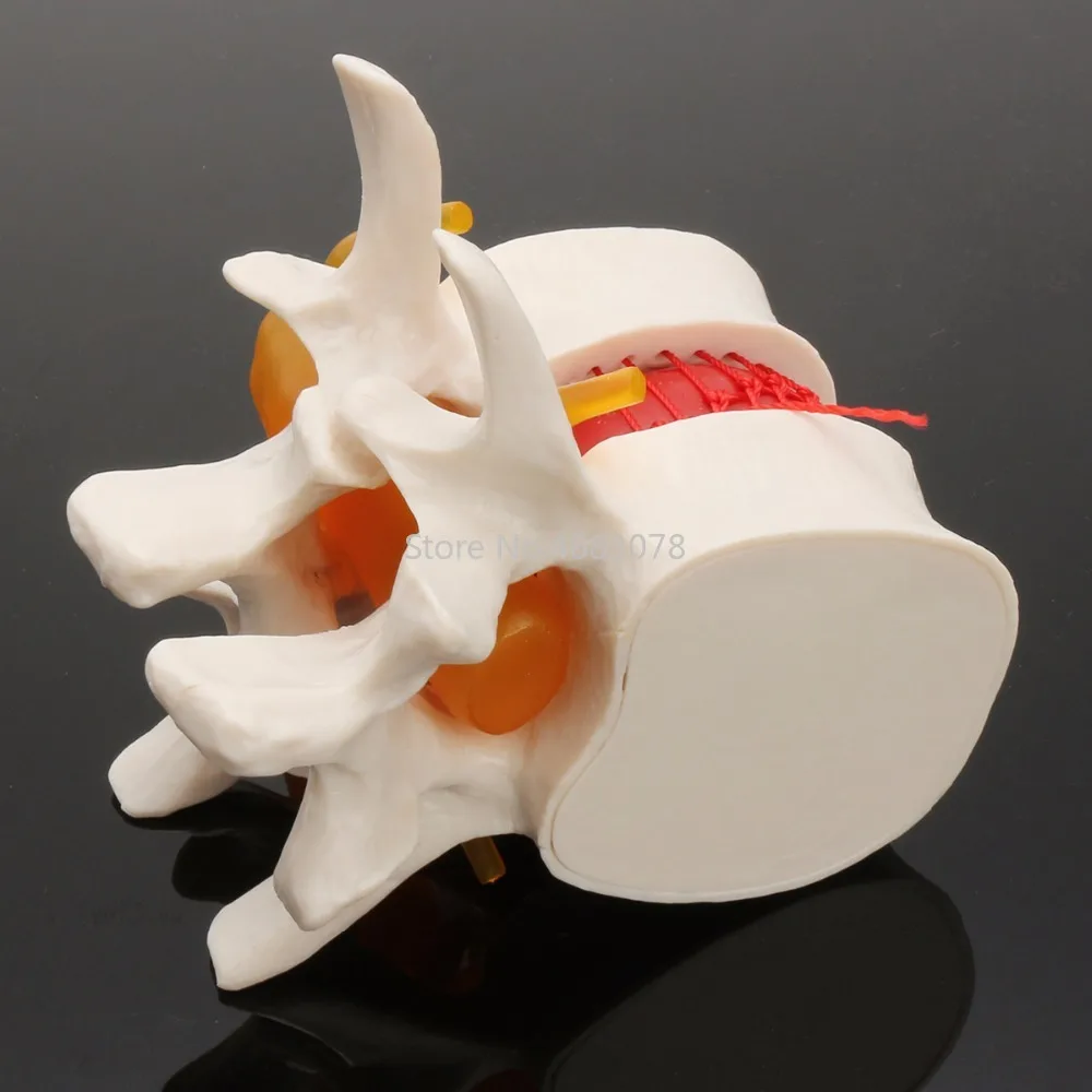 Стоматологическая 1:1 анатомический Скелет спина поясница дисковая грыжа обучающая модель