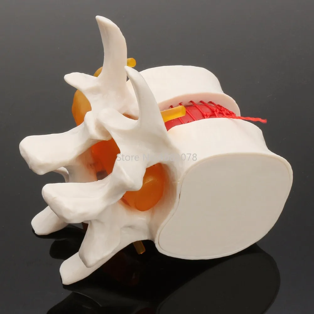 Beste Dental 11 Menselijk anatomie skelet Wervelkolom Lumbale Hernia Onderwijs Model