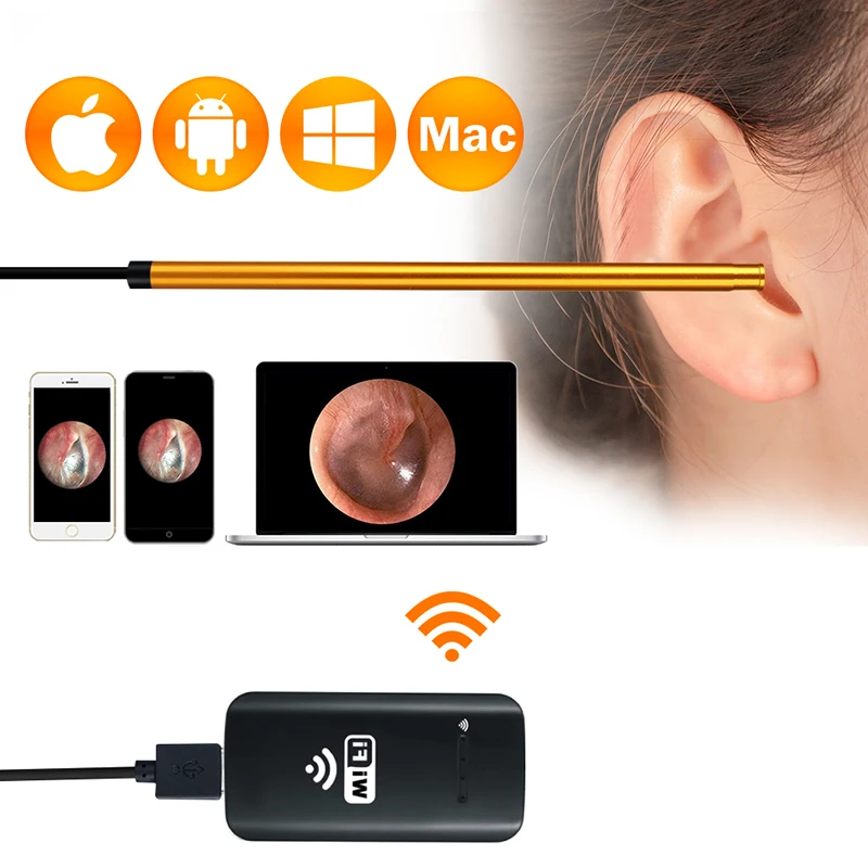 

WiFi Digital Ear Scope Inspection Ear Camera Endoscope Anti-Scald HD Visual Inspection Ear Borescope for iPhone, iPad, Android