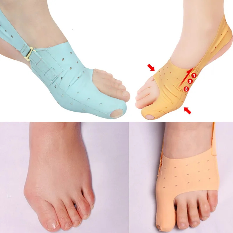 1PC Foot Braces Overlapping big Toe Separator Orthopedic Hallux Valgus Corrector Bone Thumb Silicone Correction L3 | Красота и