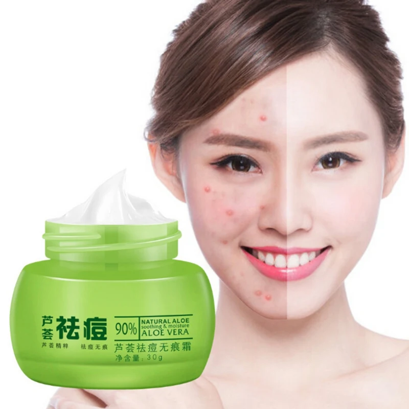 

Natural Aloe Moisturizer Remover Pimple Hydrating Remove Acne Shrinking Pores Firming Skin Facial Care Useful