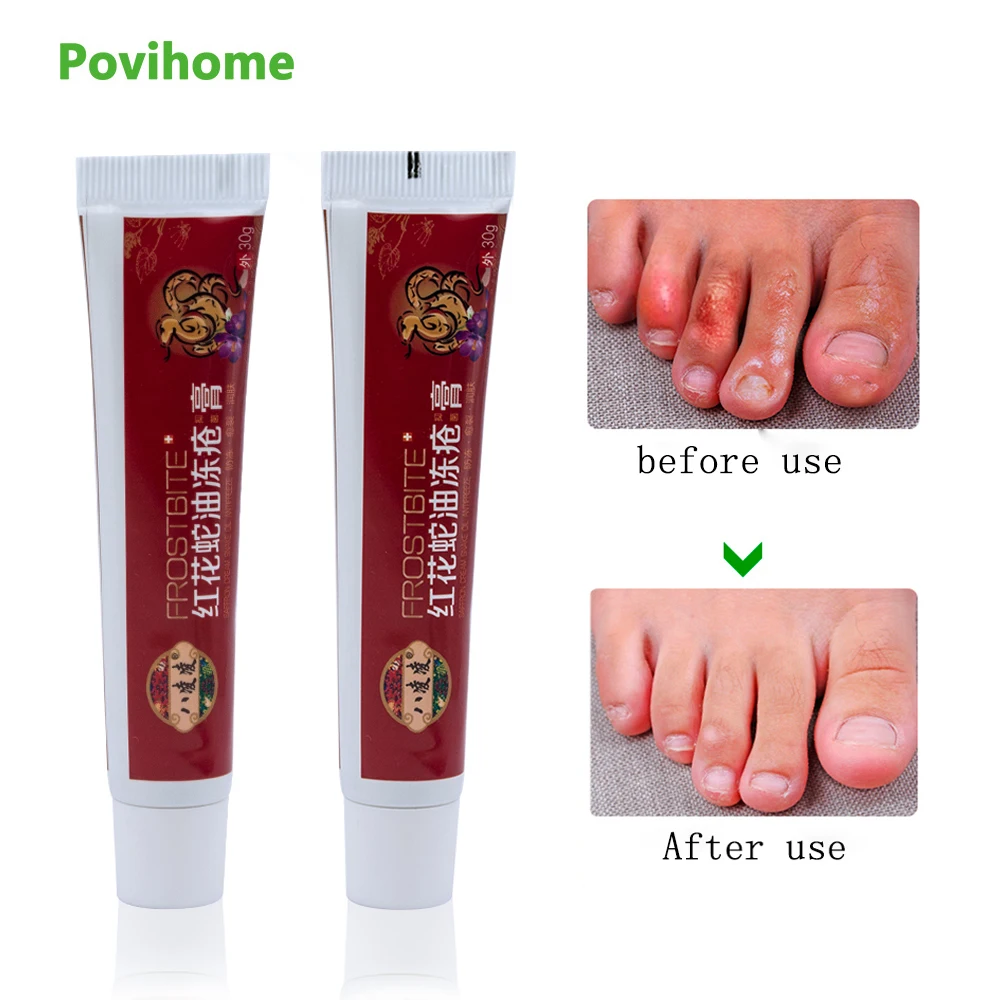 

1pcs Anti Dry Crack Cream Repair Frostbite Snake Oil Hand Foot Crack Ointment Heel Chapped Peeling Medical Plaster 30g P1010