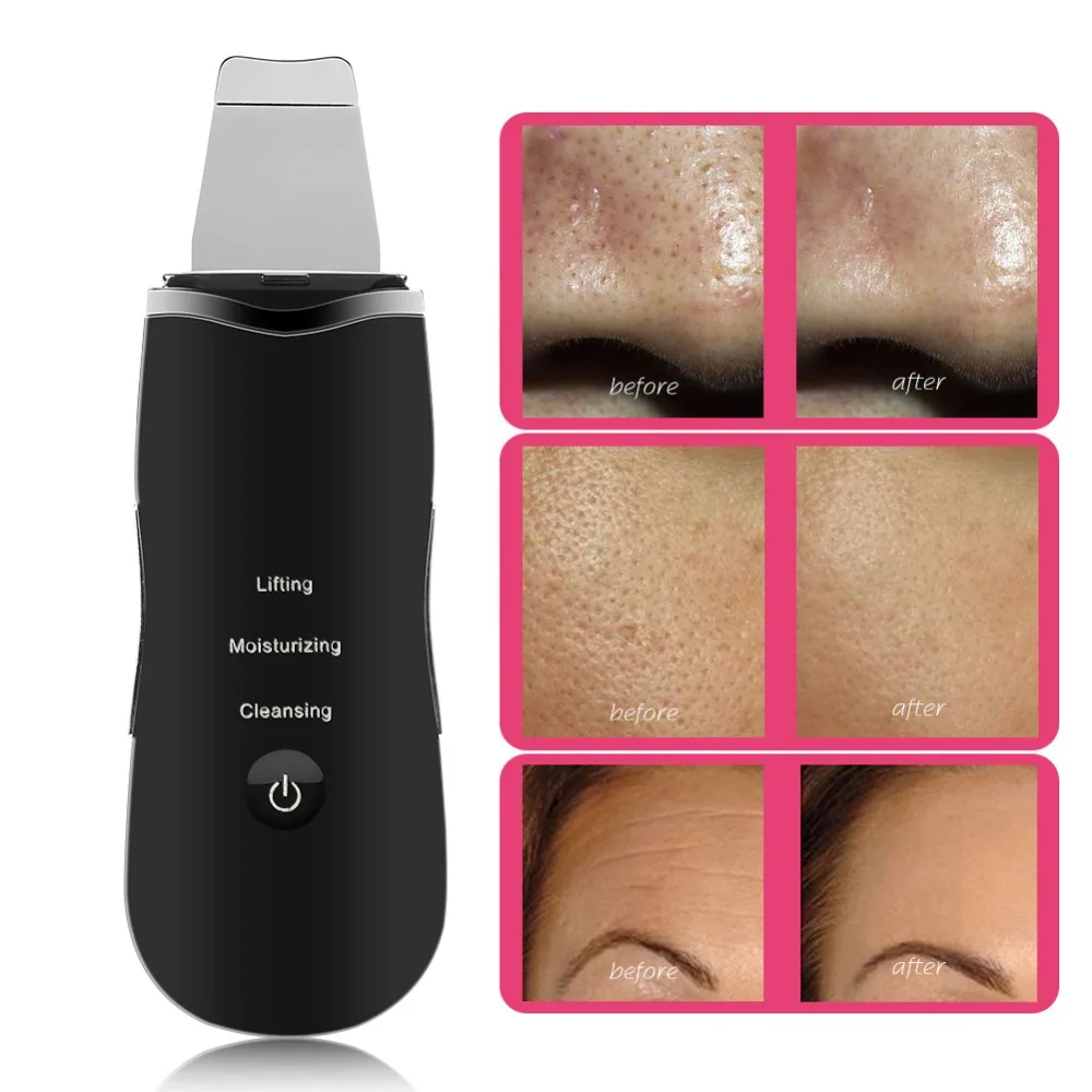 

Ultrasonic Rechargeable Face Skin Scrubber Facial Cleaning Blackhead Removal Cleaner