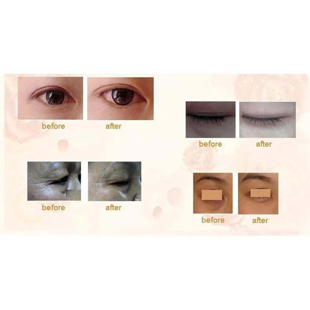 20Pcs=10P Deck Eye Mask+Gift 5Pcs Lip Mask  Out Women Crystal Eyelid Patch Anti-Wrinkle Crystal Collagen  Remove Black Eye Post