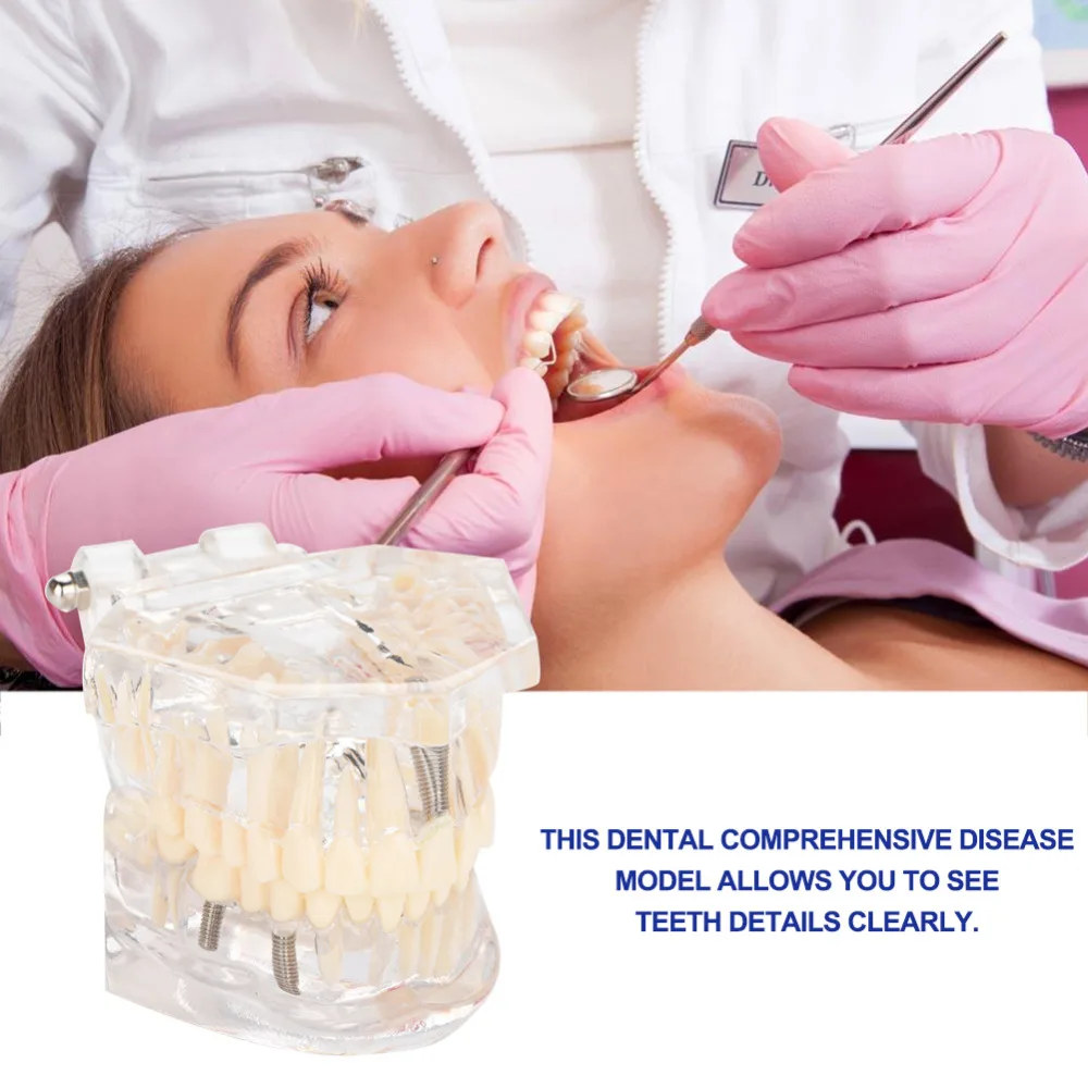 

original 1pc resin comprehensive dental practice teaching model teeth models transparent nerve removable molar tooth for all age