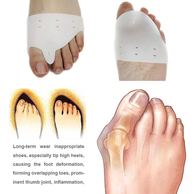 

2PCS valgus Orthotics Silicone,Toes Separator The big Toe Bunion Corrector Foot Daily Use Care Tool Orthopedic pad