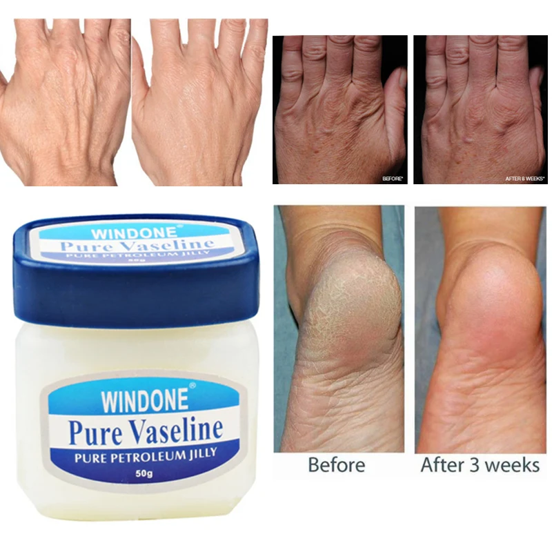 Vaseline Pure Petroleum Jelly увлажняющий крем 50 г против трещин анти трещины крем для рук Защита кожи ног Крем для замораживания