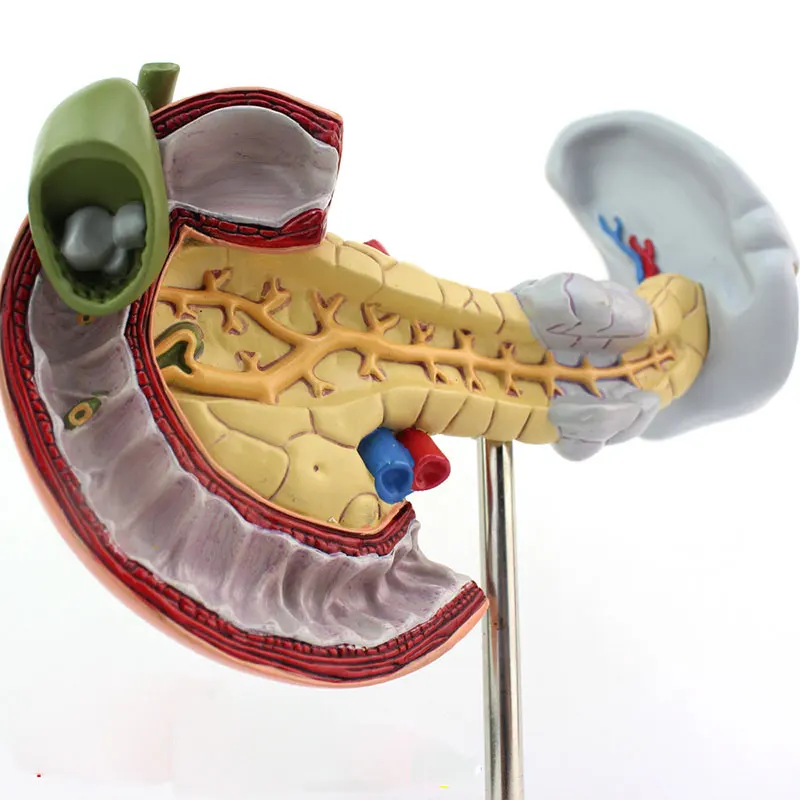 Медицинские поджелудочной двенадцатиперстной кишки и желчного пузыря патологии модели пищеварительной Системы пищеварительной модель