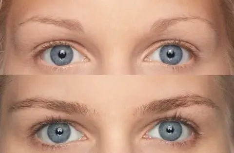 rapidbrow_canada_before_and_after_pic_480x480