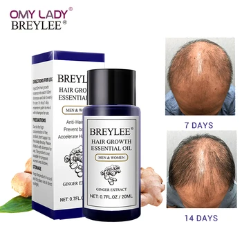 

BREYLEE Hair Growth Essential Oil 20ml Fast Powerful Hair Products Hair Care Prevent Baldness Anti-Hair Loss Serum Nourishing