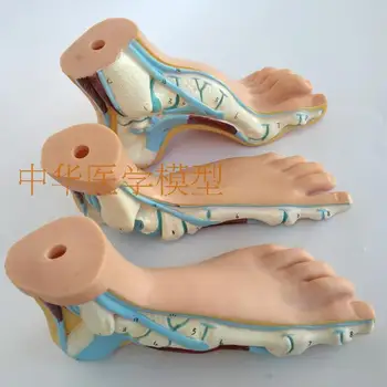 

Foot Anatomical Model Flat Foot Arcuate Foot Three-piece Foot Anatomy Model pesplanus pes arcuatus feet