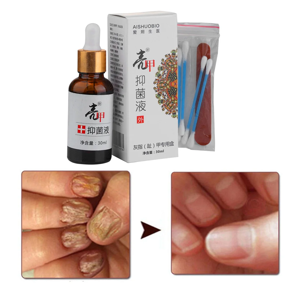 High Quality Nail Toenails Protector Nail Fungus Treatment Herb Essential Nails Repair Regeneration liquid Nail Care Tools