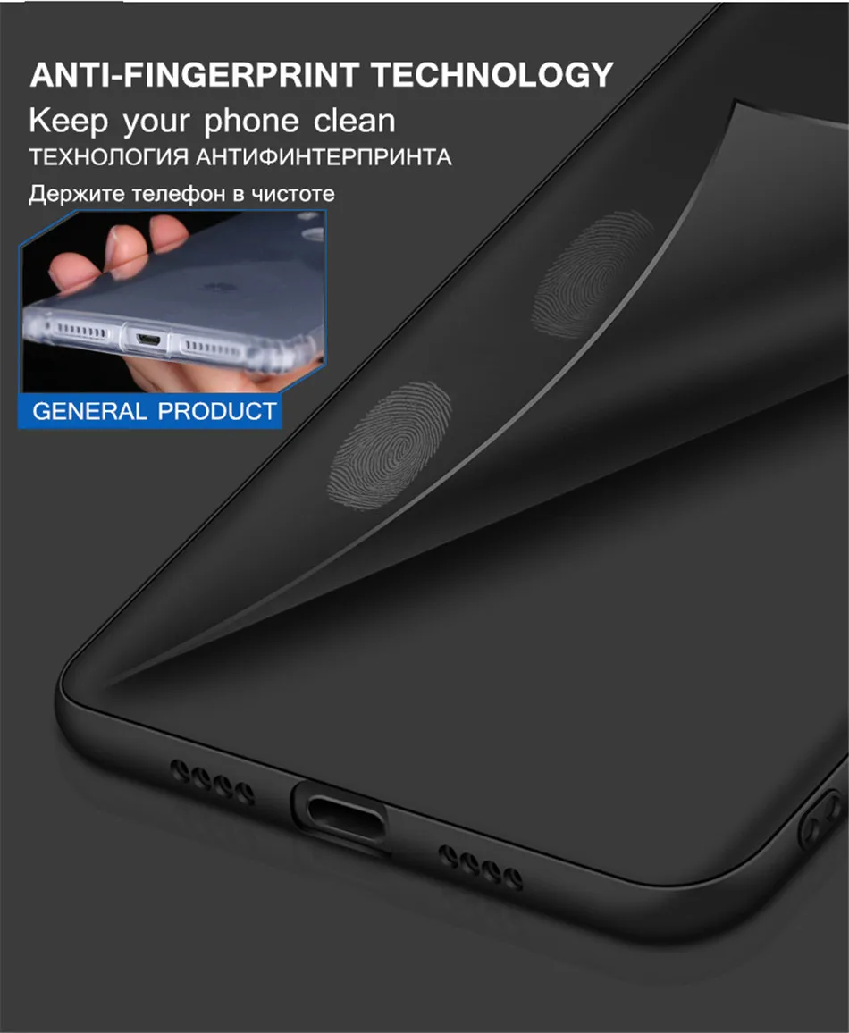 luxury xiaomi mi6 phone case3