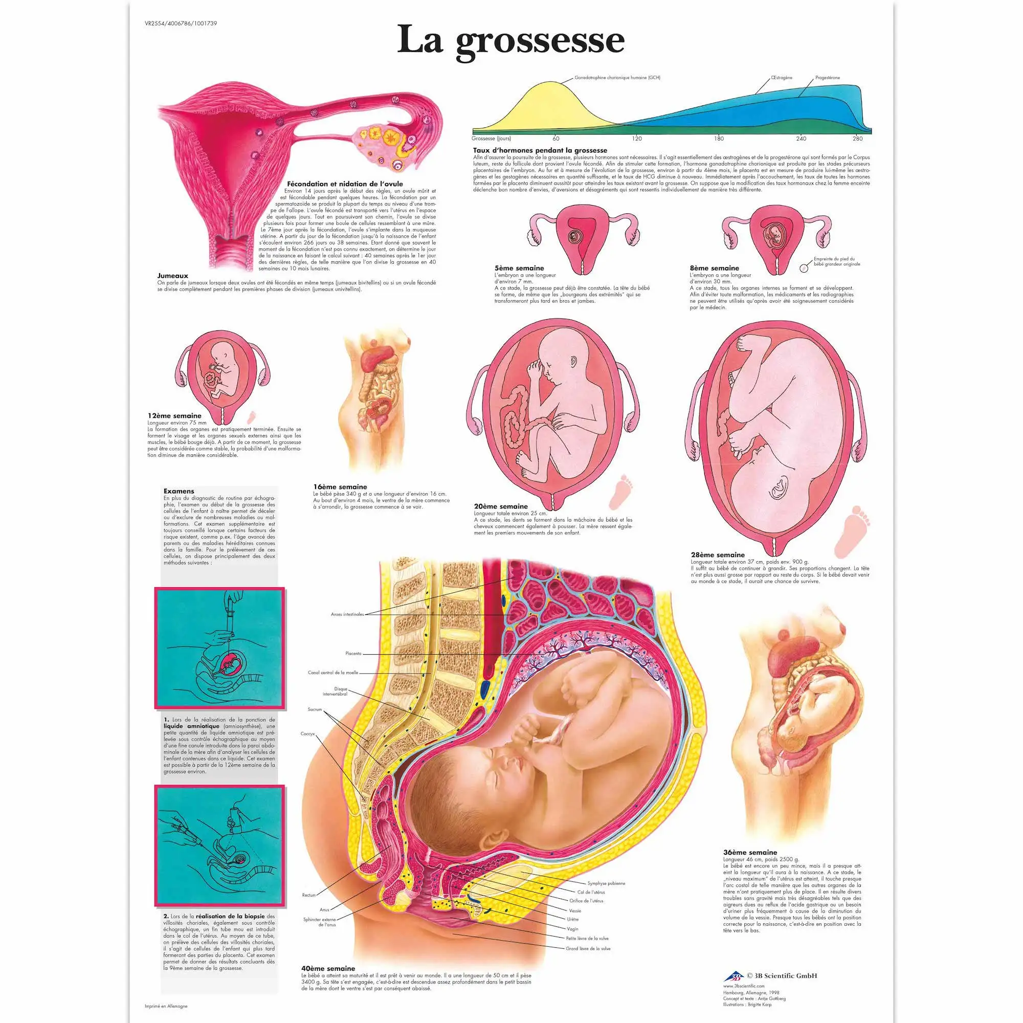 Anatomy Pathology Anatomical Poster La Grossesse Classic Canvas Paintings Vintage Wall Posters Stickers Home Decor Gift Painting Calligraphy Aliexpress