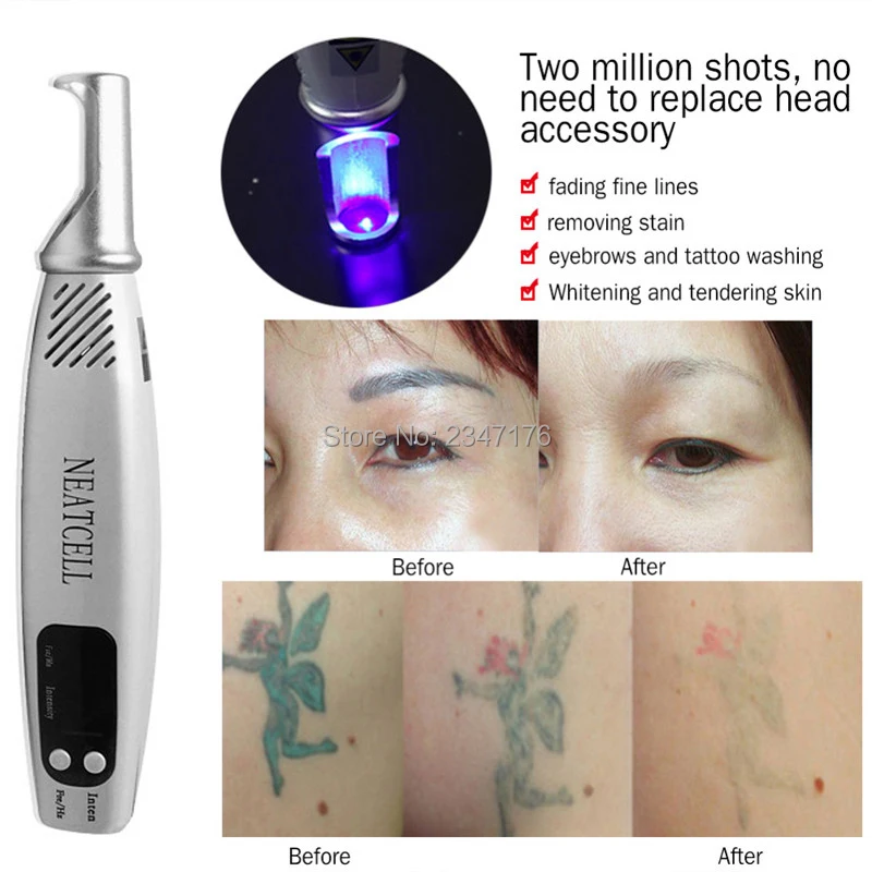 Профессиональная лазерная ручка для ухода за кожей, удаление веснушек, татуировка, удаление акне, моль, лечение веснушек, плазменная ручка, инструмент для татуировки