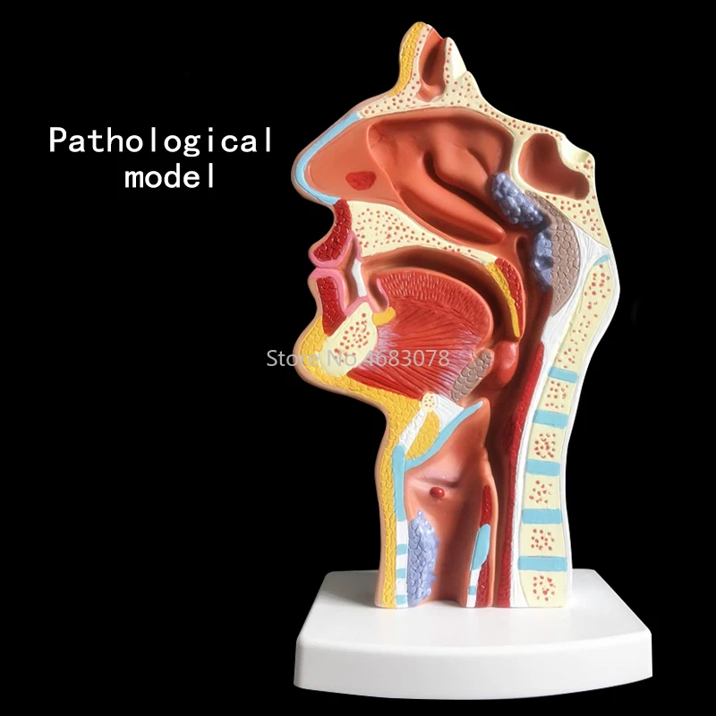 Нормальная/патологическая анатомическая модель носоглоточной полости в носовой полости и горле человеческого тела 24x12x12 см