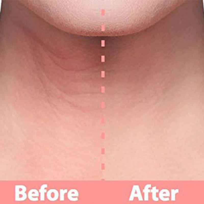 

Neck Mask Reusable for 1 Month Remove Wrinkles Whitening Skin Helps Correct Neck Wrinkles Avoid Wrinkles Pretreatment