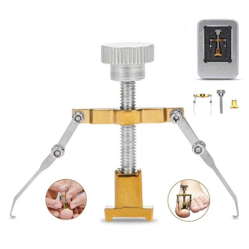 

Stainless Steel Nail Tips Puller Ingrown Toe Nail Correction Tool File for Feet Fixer Recover Corrector Toenails Nail Care New