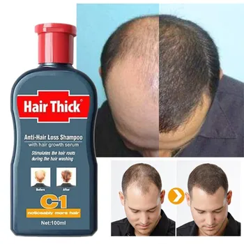 

Anti-hair loss liquid fast hair essence repair damaged rough increase ginger shampoo