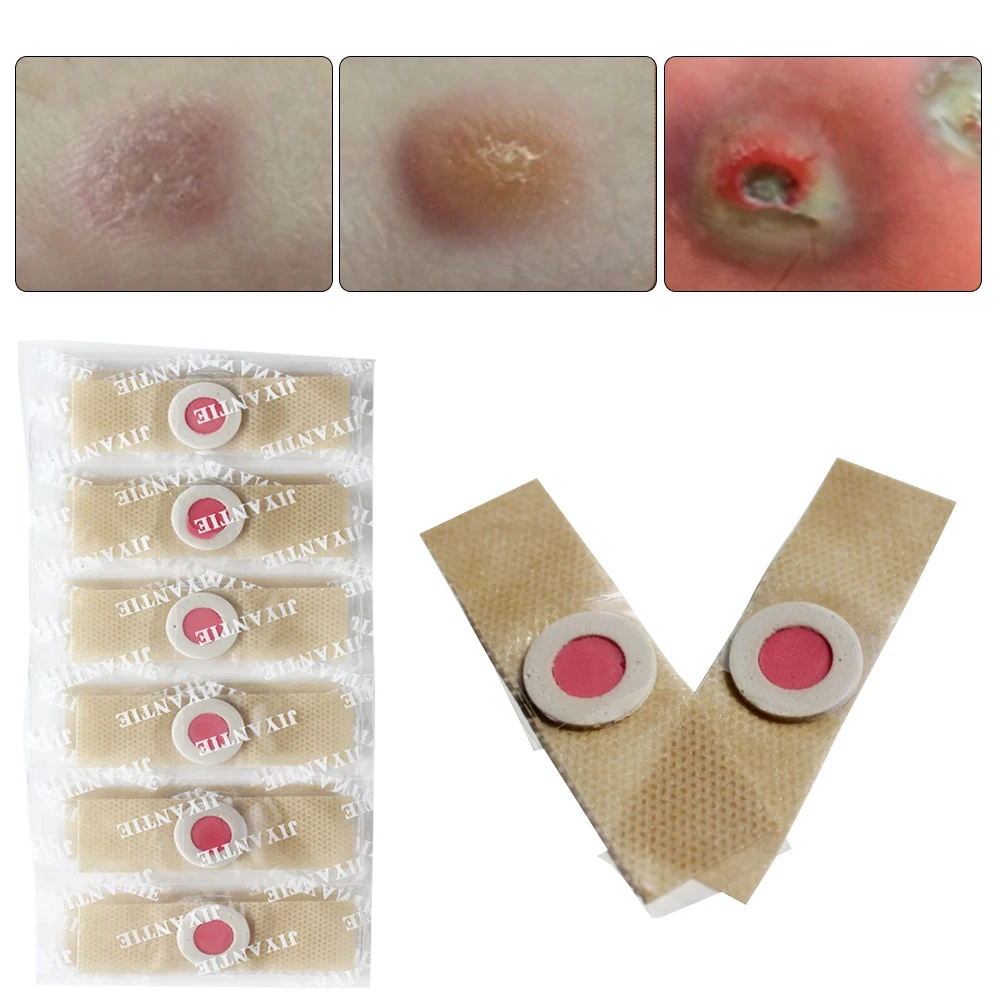 

6/12pcs Foot Corn Remover Plaster Foot Care Tools Medical Patch Relieving Blisters Corn Friction Detox Foot Pad Patches