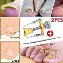 Для вросших ногтей, педикюра Уход за ногтями на ногах инструменты пилка для ног ортопедический акроникс вгребание ногтей onyxis bunion корректор для пальцев ног
