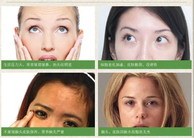 

10pcs private label anti wrinkle patch anti-wrinkle sleep forehead mask best moisturizing wrinkle face patch free shipping
