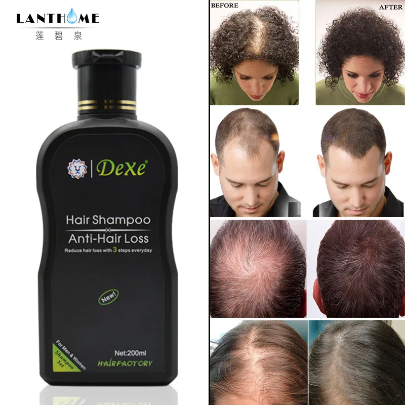 200 мл Dexe шампунь для волос набор против выпадения волос Китайский травяной стимулирующий рост волос продукт предотвращает лечение волос для мужчин и женщин
