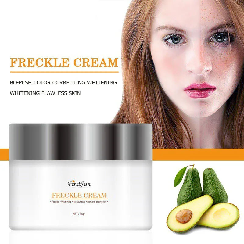 30g Professional Remove Melasma Spots Pigment Melanin Powerful Whitening Freckle Moisturizer