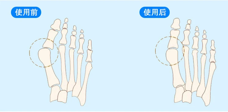 Высокое качество ортез вальгуса для пальцы ноги( у нас завод в Китае, поэтому я обещаю у нас хорошая качества и хорошая цена