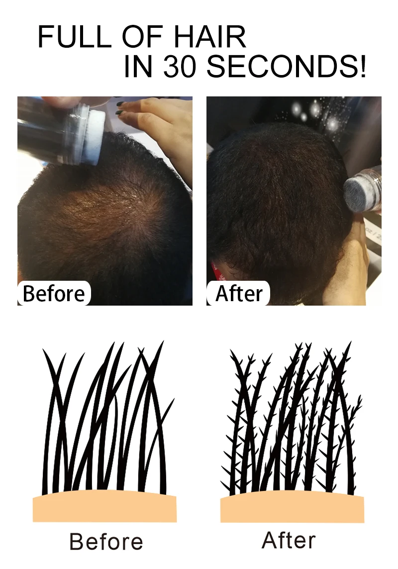 Sevich восстановление волос кератин утолщение волос здание мгновенно 25 г волос волокна порошок спрей аппликатор черный/dk коричневый